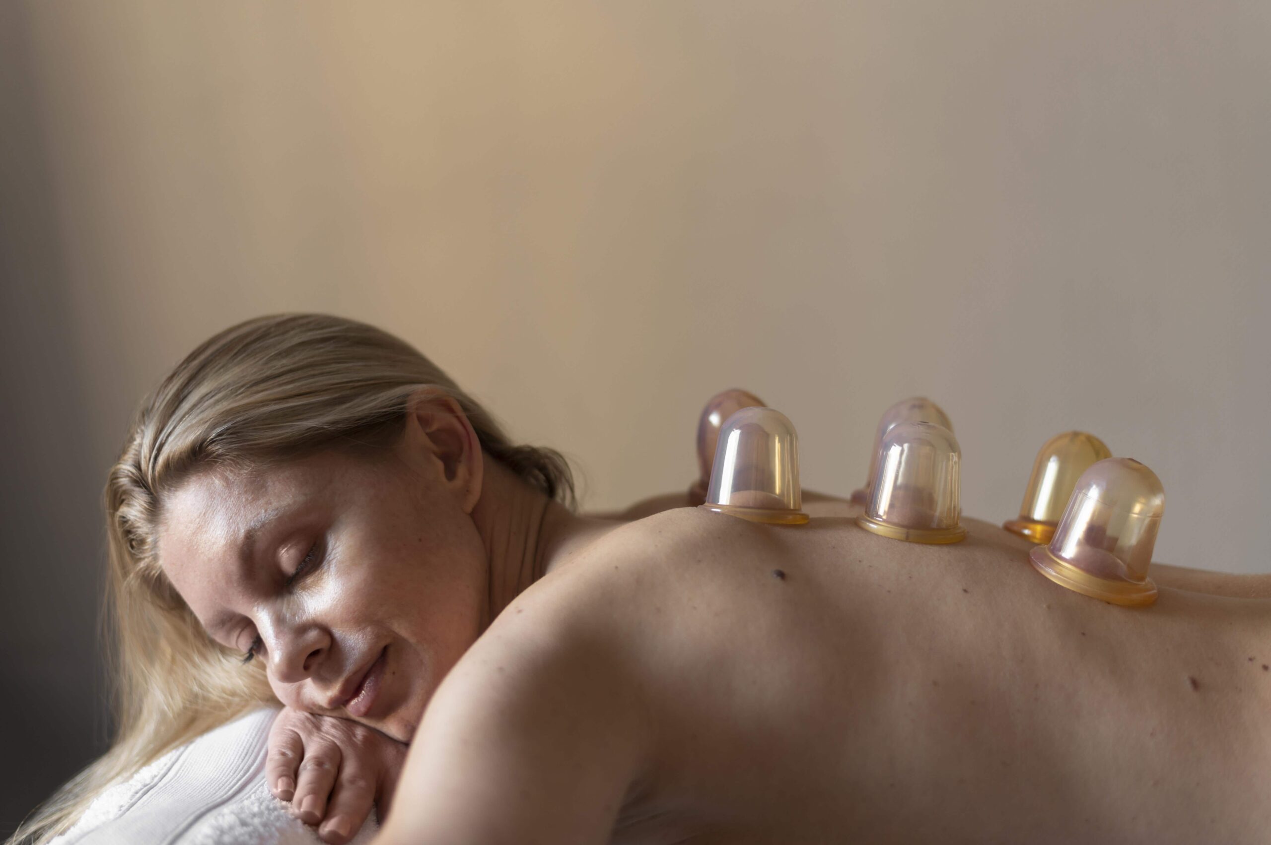 masaje con ventosas. min masaje con ventosas edyn med spa