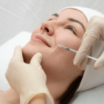 tratamiento Dermal Filler Edyn Med Spa